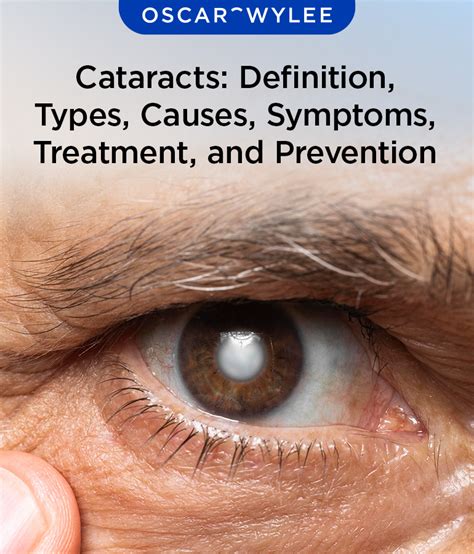What Causes Cataracts To Develop Quickly